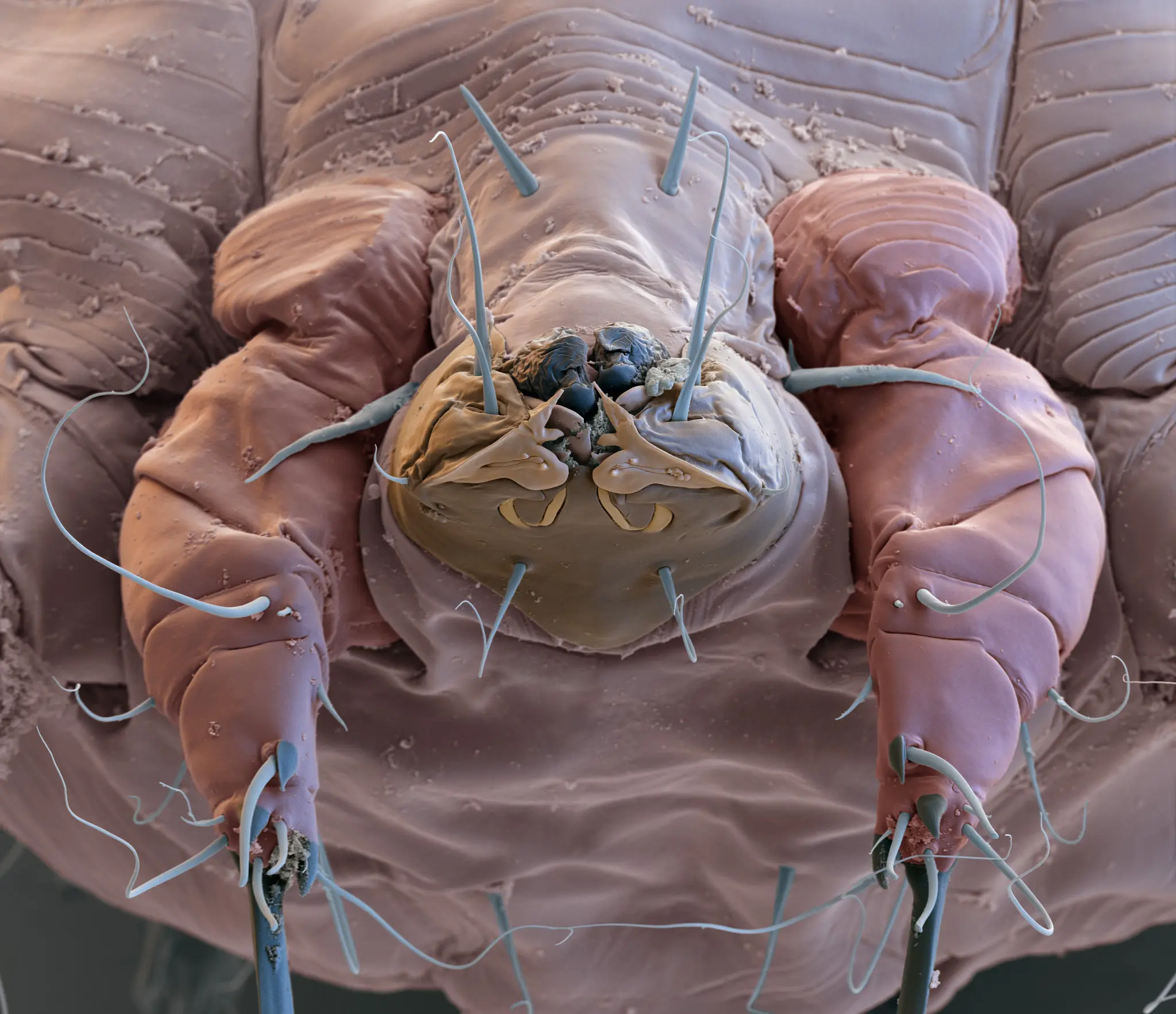 Breakthrough Oral Drug Offers Hope in Global Fight Against Scabies Breakthrough Oral Drug Offers Hope in Global Fight Against Scabies